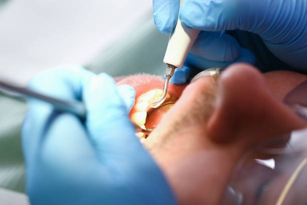 Best Emergency Gum Treatment in USA